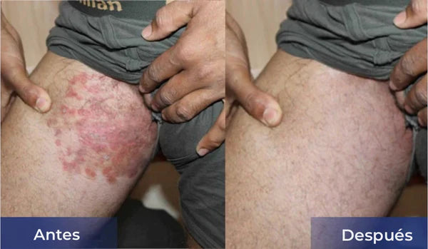 Crema Alivio Rápido